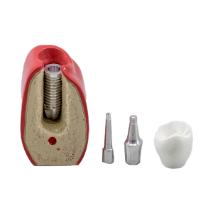 MACRO MODELO UNITÁRIO - CONE MORSE - cód. 9764
