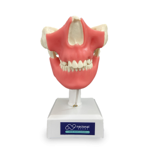 MANEQUIM COM DENTES INCLUSOS E GENGIVA - DENTES 13, 23, 18, 28, 38 E 48 - cód. 11491GT