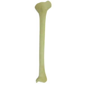 TÍBIA COM DEFORMIDADE PROXIMAL VARO ROTAÇÃO INTERNA - ESQUERDA - cód. 2026 DPVR