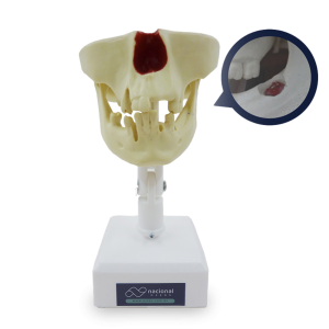 MANEQUIM PRÉ-MOLAR COM 3º MOLAR INCLUSO - cód. 4401
